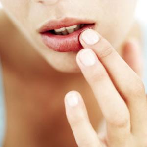 Wirksame Heilmittel gegen Erkältungen auf den Lippen