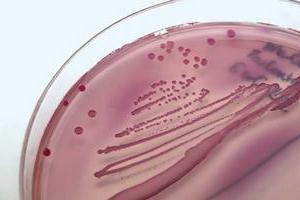 Woher kommt Escherichia coli aus dem Urin?